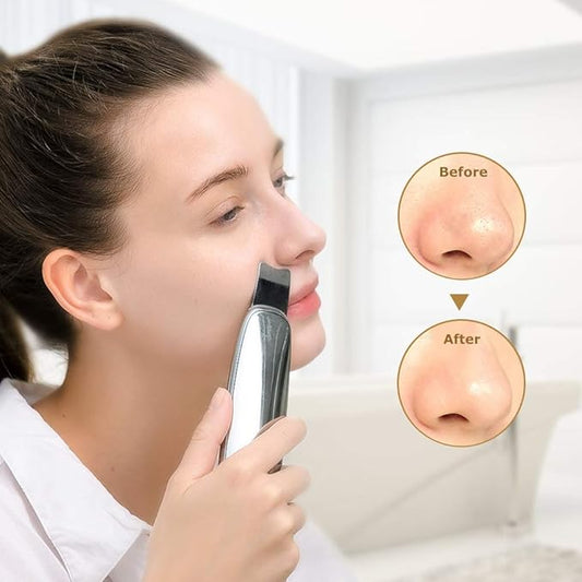 Espatula Ultrasonica de Limpieza Facial - GoldenFace