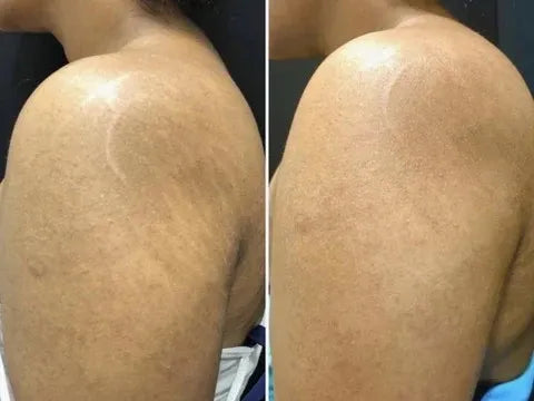 Guante Exfoliante Elimina Piel Muerta