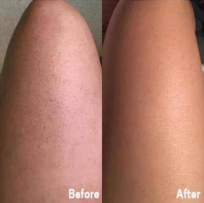 Guante Exfoliante Elimina Piel Muerta